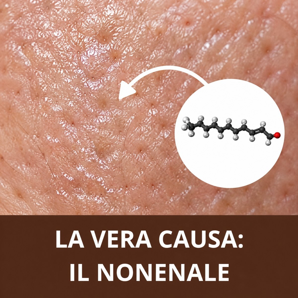 Pelle matura al microscopio e la molecola del nonenale